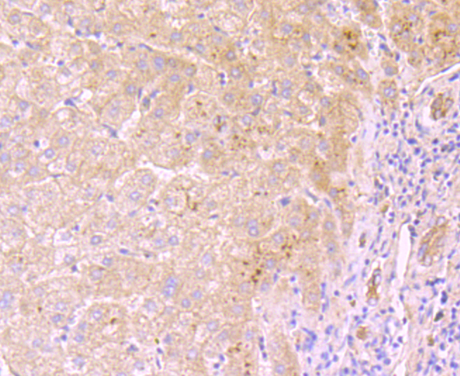Immunohistochemical analysis of paraffin-embedded human liver tissue using anti-PCSK9 antibody. Counter stained with hematoxylin.