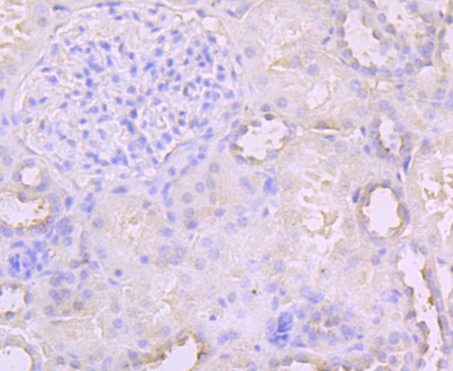 Immunohistochemical analysis of paraffin-embedded human kidney tissue using anti-PCSK9 antibody. Counter stained with hematoxylin.