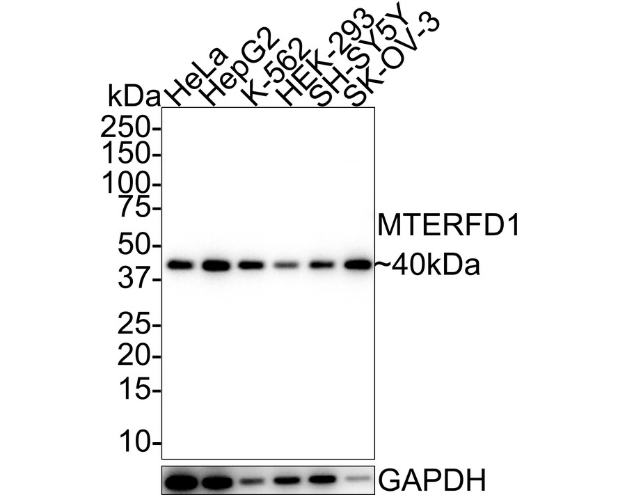 Western blot analysis of MTERFD1 on different lysates using anti-MTERFD1 antibody at 1/1,000 dilution.<br />
Positive control:<br />
Lane 1: Hela cell lysates<br />
Lane 2: Mouse kidney tissue lysates<br />
Lane 3: K562 cell lysates