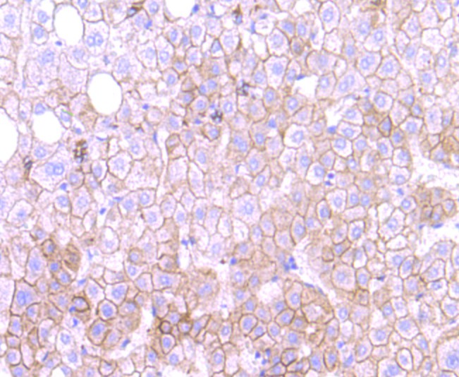 Immunohistochemical analysis of paraffin-embedded human liver tissue using anti-MTERFD1 antibody. Counter stained with hematoxylin.