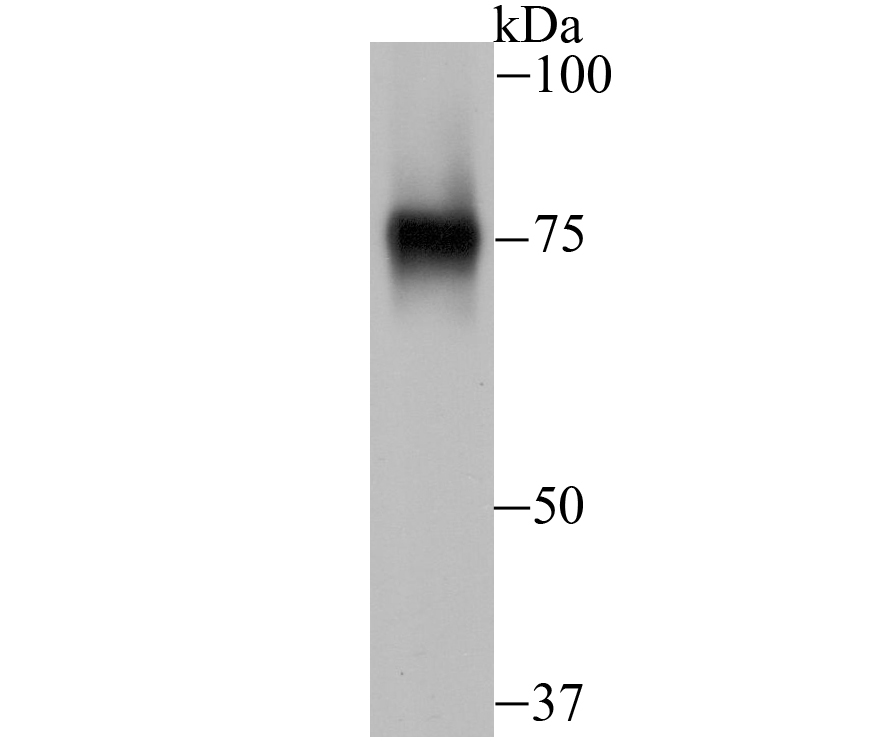 Western blot analysis of AFP on human placenta tissue lysate using anti-AFP antibody at 1/1,000 dilution.