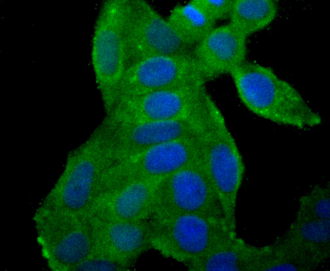 ICC staining AFP (green) in HepG2 cells. The nuclear counter stain is DAPI (blue). Cells were fixed in paraformaldehyde, permeabilised with 0.25% Triton X100/PBS.