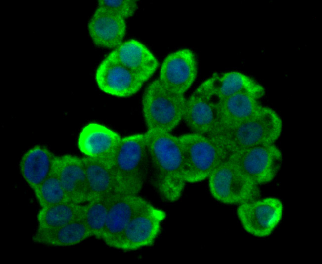 ICC staining B Raf (green) in LOVO cells. The nuclear counter stain is DAPI (blue). Cells were fixed in paraformaldehyde, permeabilised with 0.25% Triton X100/PBS.