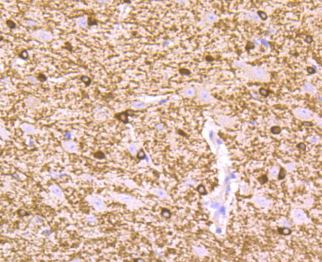Immunohistochemical analysis of paraffin-embedded mouse brain tissue using anti-B Raf antibody. Counter stained with hematoxylin.