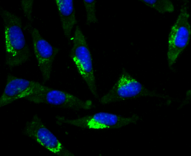ICC staining Glucagon (green) in SH-SY5Y cells. The nuclear counter stain is DAPI (blue). Cells were fixed in paraformaldehyde, permeabilised with 0.25% Triton X100/PBS.