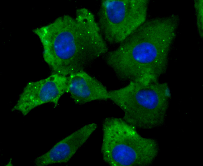 ICC staining NaV1.7 (green) in A549 cells. The nuclear counter stain is DAPI (blue). Cells were fixed in paraformaldehyde, permeabilised with 0.25% Triton X100/PBS.