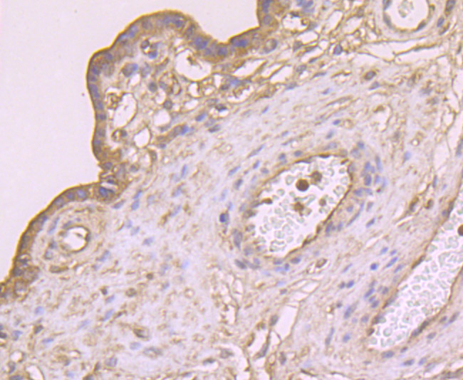 Immunohistochemical analysis of paraffin-embedded human placenta tissue using anti-CTHRC1 antibody. Counter stained with hematoxylin.