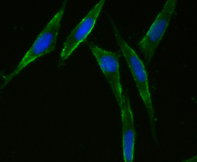 ICC staining CD47 (green) in SH-SY5Y cells. The nuclear counter stain is DAPI (blue). Cells were fixed in paraformaldehyde, permeabilised with 0.25% Triton X100/PBS.