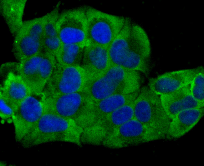 ICC staining Cardiac Troponin T (green) in Hela cells. The nuclear counter stain is DAPI (blue). Cells were fixed in paraformaldehyde, permeabilised with 0.25% Triton X100/PBS.