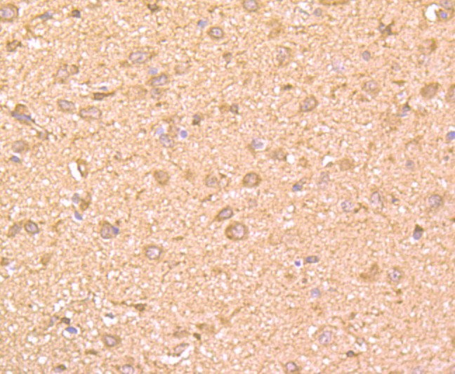 Immunohistochemical analysis of paraffin-embedded rat brain tissue using anti-GRB2 antibody. Counter stained with hematoxylin.