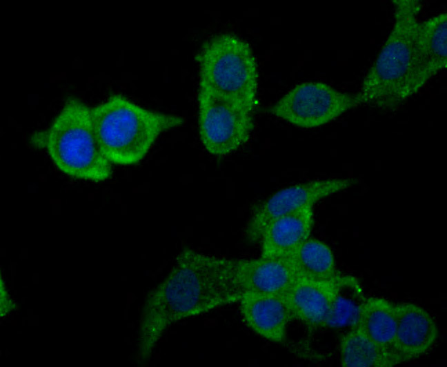 ICC staining CD11b (green) in LOVO cells. The nuclear counter stain is DAPI (blue). Cells were fixed in paraformaldehyde, permeabilised with 0.25% Triton X100/PBS.