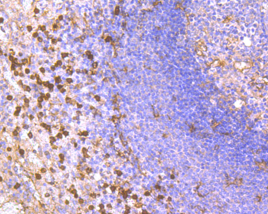 Immunohistochemical analysis of paraffin-embedded human spleen tissue using anti-CD11b antibody. Counter stained with hematoxylin.