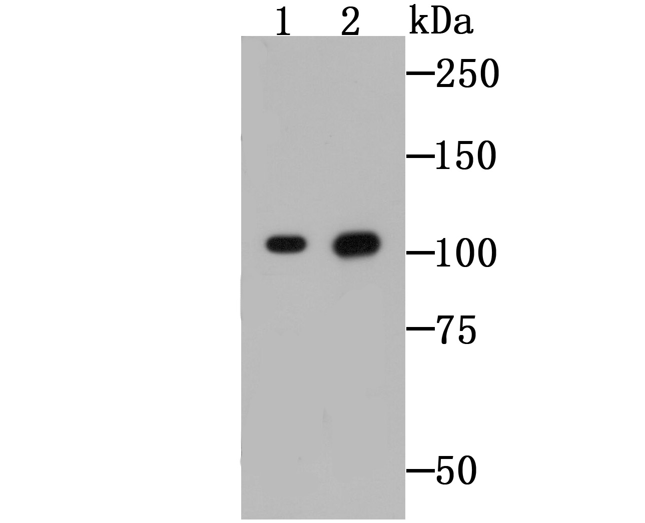 Western blot analysis of CD130 on Raji cell (1) and mouse lung tissue (2) lysates using anti-CD130 antibody at 1/500 dilution.