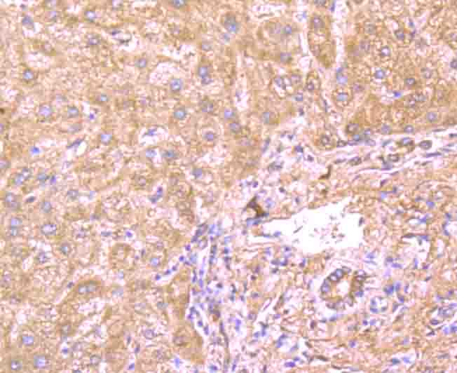 Immunohistochemical analysis of paraffin-embedded human liver tissue using anti-CD130 antibody. Counter stained with hematoxylin.