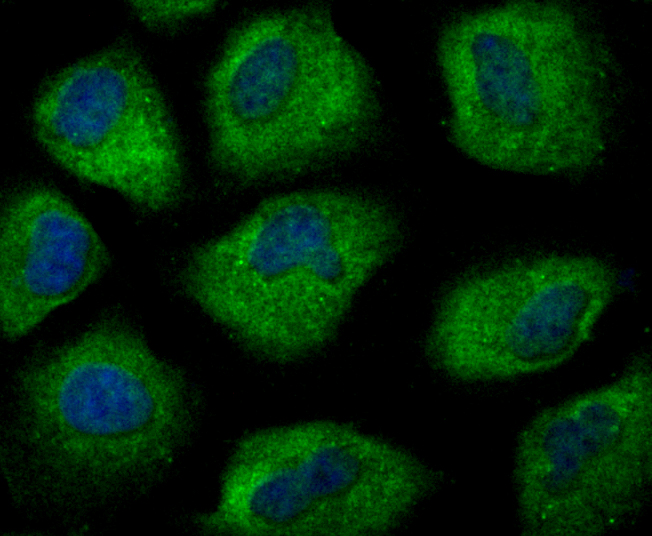 ICC staining Smad2 (green) in HUVEC cells. The nuclear counter stain is DAPI (blue). Cells were fixed in paraformaldehyde, permeabilised with 0.25% Triton X100/PBS.