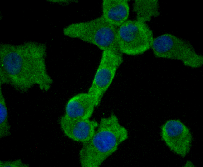 ICC staining Smad2 (green) in A549 cells. The nuclear counter stain is DAPI (blue). Cells were fixed in paraformaldehyde, permeabilised with 0.25% Triton X100/PBS.