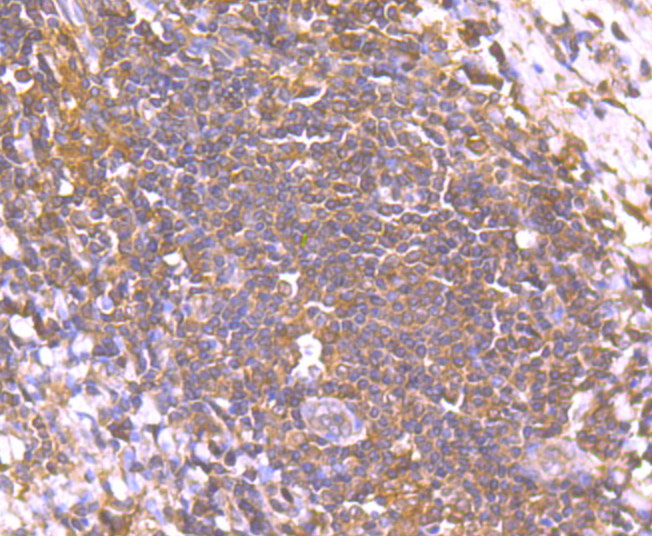 Immunohistochemical analysis of paraffin-embedded human tonsil tissue using anti-Smad2 antibody. Counter stained with hematoxylin.