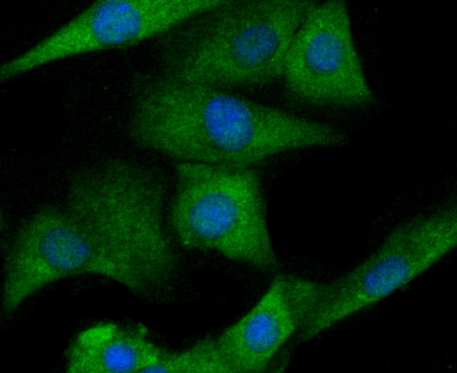 ICC staining of IL6 in NIH/3T3 cells (green). Formalin fixed cells were permeabilized with 0.1% Triton X-100 in TBS for 10 minutes at room temperature and blocked with 10% negative goat serum for 15 minutes at room temperature. Cells were probed with the primary antibody (EM1701-45, 1/50) for 1 hour at room temperature, washed with PBS. Alexa Fluor®488 conjugate-Goat anti-Mouse IgG was used as the secondary antibody at 1/1,000 dilution. The nuclear counter stain is DAPI (blue).