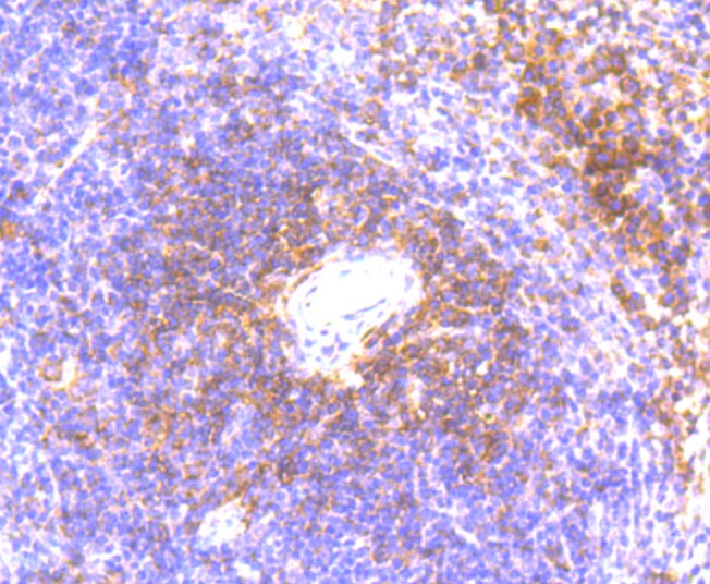 Immunohistochemical analysis of paraffin-embedded mouse spleen tissue using anti-IL6 antibody. The section was pre-treated using heat mediated antigen retrieval with Tris-EDTA buffer (pH 9.0) for 20 minutes.The tissues were blocked in 1% BSA for 30 minutes at room temperature, washed with ddH2O and PBS, and then probed with the primary antibody (EM1701-45, 1/50) for 30 minutes at room temperature. The detection was performed using an HRP conjugated compact polymer system. DAB was used as the chromogen. Tissues were counterstained with hematoxylin and mounted with DPX.