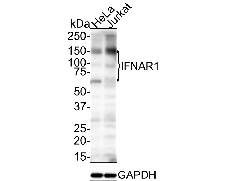 Western blot analysis of IFNAR1 on different lysates using anti- IFNAR1 antibody at 1/500 dilution. <br />
  Positive control:<br />
  Lane 1: K562 <br />
  Lane 1: A431<br />
  Lane 1: Siha <br />
  Lane 1: Mouse brain tissue