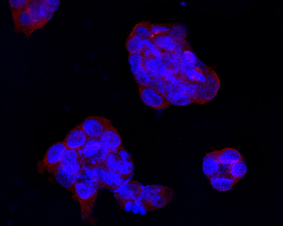 ICC staining IFNAR1(red) in NCCIT cells. The nuclear counter stain is DAPI (blue). Cells were fixed in paraformaldehyde, permeabilised with 0.25% Triton X100/PBS.