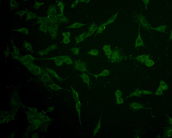 ICC staining IFNAR1(green) in SHG-44 cells. Cells were fixed in paraformaldehyde, permeabilised with 0.25% Triton X100/PBS.