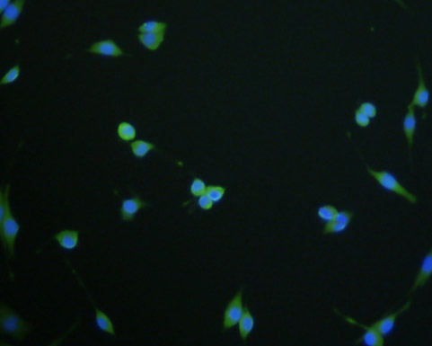ICC staining LNP (green) in SHG-44 cells. The nuclear counter stain is DAPI (blue). Cells were fixed in paraformaldehyde, permeabilised with 0.25% Triton X100/PBS.