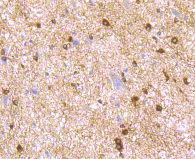 Immunohistochemical analysis of paraffin-embedded rat spinal cord tissue using anti-LNP antibody. Counter stained with hematoxylin.