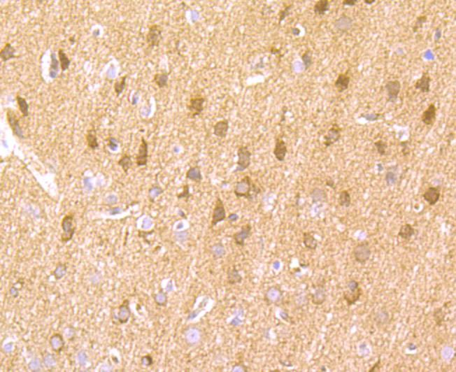 Immunohistochemical analysis of paraffin-embedded rat brain tissue using anti-LNP antibody. Counter stained with hematoxylin.