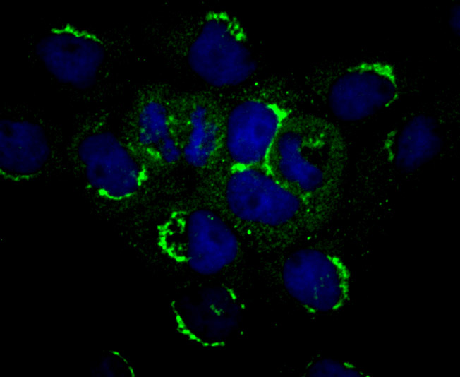 ICC staining PLEKHH1 (green) in A431 cells. The nuclear counter stain is DAPI (blue). Cells were fixed in paraformaldehyde, permeabilised with 0.25% Triton X100/PBS.