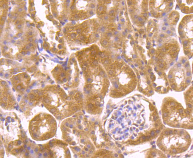 Immunohistochemical analysis of paraffin-embedded mouse kidney tissue using anti-PLEKHH1 antibody. Counter stained with hematoxylin.