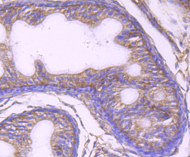 Immunohistochemical analysis of paraffin-embedded rat epididymis tissue using anti-UAP1 antibody. The section was pre-treated using heat mediated antigen retrieval with Tris-EDTA buffer (pH 8.0-8.4) for 20 minutes.The tissues were blocked in 5% BSA for 30 minutes at room temperature, washed with ddH2O and PBS, and then probed with the primary antibody (EM1701-50, 1/50) for 30 minutes at room temperature. The detection was performed using an HRP conjugated compact polymer system. DAB was used as the chromogen. Tissues were counterstained with hematoxylin and mounted with DPX.