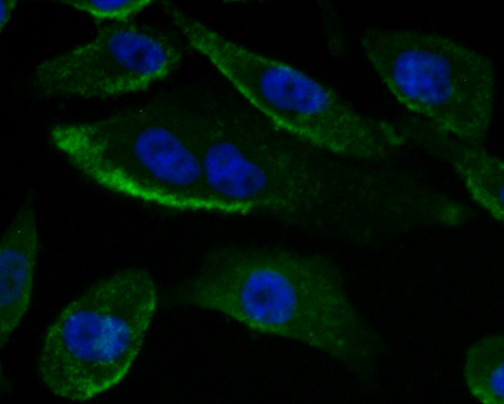 ICC staining Gp83 in PC-3M cells (green). The nuclear counter stain is DAPI (blue). Cells were fixed in paraformaldehyde, permeabilised with 0.25% Triton X100/PBS.