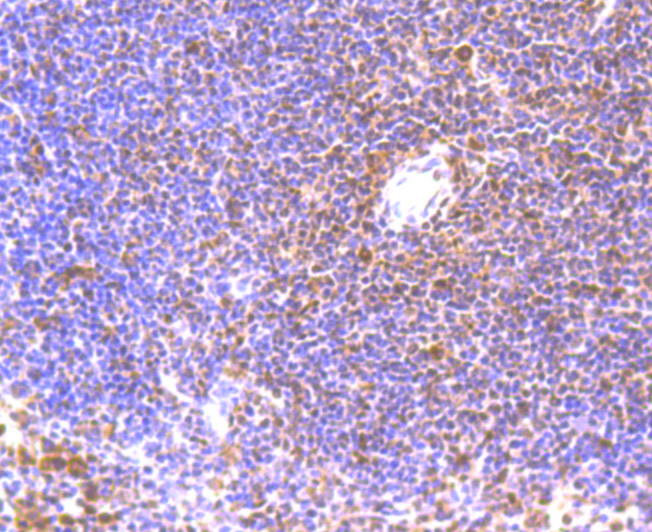 Immunohistochemical analysis of paraffin-embedded mouse spleen tissue using anti-Bmi1 antibody. Counter stained with hematoxylin.