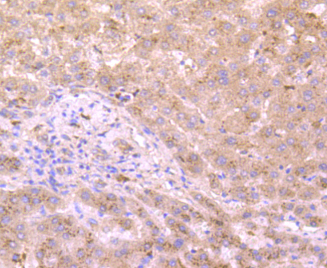 Immunohistochemical analysis of paraffin-embedded human liver tissue using anti-xanthine dehydrogenase antibody. Counter stained with hematoxylin.