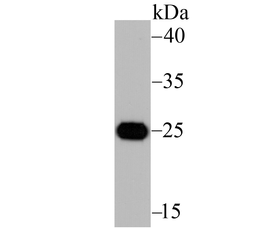 Western blot analysis of IL6 on recombinant protein lysate using anti-IL6 antibody at 1/1,000 dilution.