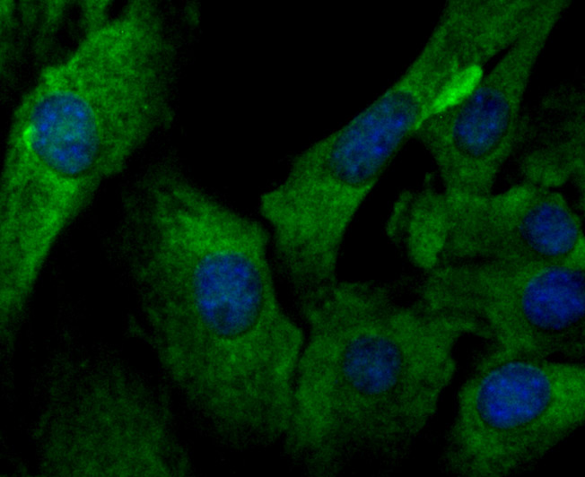 ICC staining of IL-6 in NIH/3T3 cells (green). Formalin fixed cells were permeabilized with 0.1% Triton X-100 in TBS for 10 minutes at room temperature and blocked with 10% negative goat serum for 15 minutes at room temperature. Cells were probed with the primary antibody (EM1701-58, 1/50) for 1 hour at room temperature, washed with PBS. Alexa Fluor®488 conjugate-Goat anti-Mouse IgG was used as the secondary antibody at 1/1,000 dilution. The nuclear counter stain is DAPI (blue).