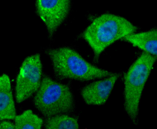 ICC staining of IL-6 in PC-3M cells (green). Formalin fixed cells were permeabilized with 0.1% Triton X-100 in TBS for 10 minutes at room temperature and blocked with 10% negative goat serum for 15 minutes at room temperature. Cells were probed with the primary antibody (EM1701-58, 1/50) for 1 hour at room temperature, washed with PBS. Alexa Fluor®488 conjugate-Goat anti-Mouse IgG was used as the secondary antibody at 1/1,000 dilution. The nuclear counter stain is DAPI (blue).