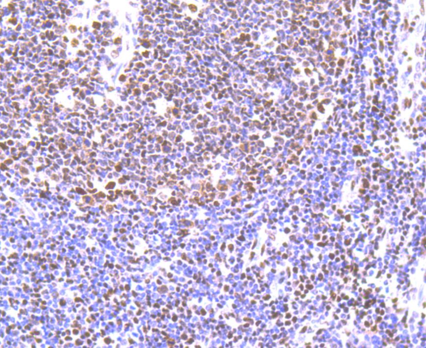 Immunohistochemical analysis of paraffin-embedded human tonsil tissue using anti-IL6 antibody. The section was pre-treated using heat mediated antigen retrieval with Tris-EDTA buffer (pH 9.0) for 20 minutes.The tissues were blocked in 1% BSA for 30 minutes at room temperature, washed with ddH2O and PBS, and then probed with the primary antibody (EM1701-58, 1/50) for 30 minutes at room temperature. The detection was performed using an HRP conjugated compact polymer system. DAB was used as the chromogen. Tissues were counterstained with hematoxylin and mounted with DPX.