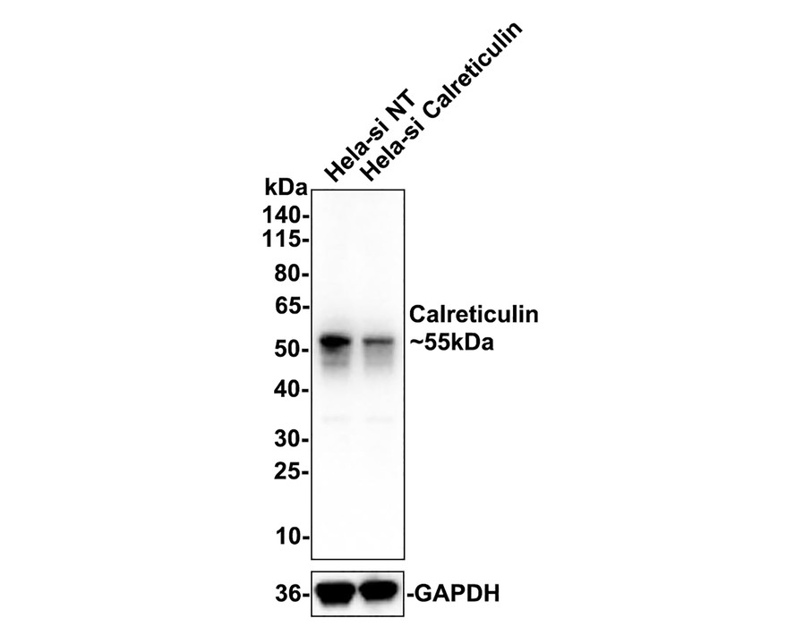 Western blot analysis of Calreticulin on different lysates with Rabbit anti-Calreticulin antibody (EM1701-60) at 1/500 dilution.<br />
<br />
Lane 1: Hela-si-NT cell lysate<br />
Lane 2: Hela-si-Calreticulin cell lysate<br />
<br />
Lysates/proteins at 10 µg/Lane.<br />
<br />
Predicted band size: 48 kDa<br />
Observed band size: 55 kDa<br />
<br />
Exposure time: 5 seconds;<br />
<br />
4-20% SDS-PAGE gel.<br />
<br />
EM1701-60 was shown to specifically react with Calreticulin in Hela-si-NT cells. Weakened band was observed when Hela-si-Calreticulin sample was tested. Hela-si-NT and Hela-si-Calreticulin samples were subjected to SDS-PAGE. Proteins were transferred to a PVDF membrane and blocked with 5% NFDM in TBST for 1 hour at room temperature. The primary antibody (EM1701-60, 1/500) and Loading control antibody (Rabbit anti-GAPDH, ET1601-4, 1/10,000) were used in 5% BSA at room temperature for 2 hours. Goat Anti-mouse IgG-HRP Secondary Antibody (HA1006) at 1:150,000 dilution was used for 1 hour at room temperature.