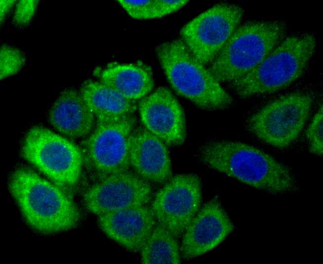 ICC staining Calreticulin (green) in HepG2 cells. The nuclear counter stain is DAPI (blue). Cells were fixed in paraformaldehyde, permeabilised with 0.25% Triton X100/PBS.