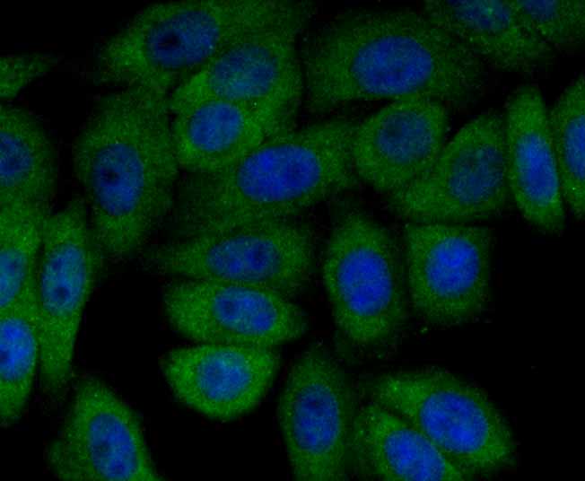 ICC staining PI 3 Kinase p85 alpha (green) in HepG2 cells. The nuclear counter stain is DAPI (blue). Cells were fixed in paraformaldehyde, permeabilised with 0.25% Triton X100/PBS.