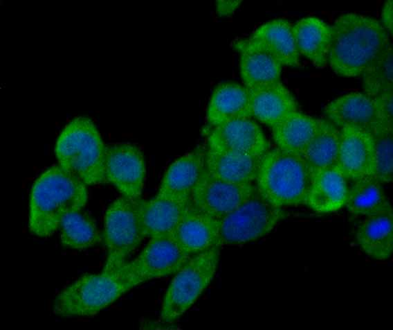 ICC staining PI3-kinase p85 subunit alpha (green) in LOVO cells. The nuclear counter stain is DAPI (blue). Cells were fixed in paraformaldehyde, permeabilised with 0.25% Triton X100/PBS.