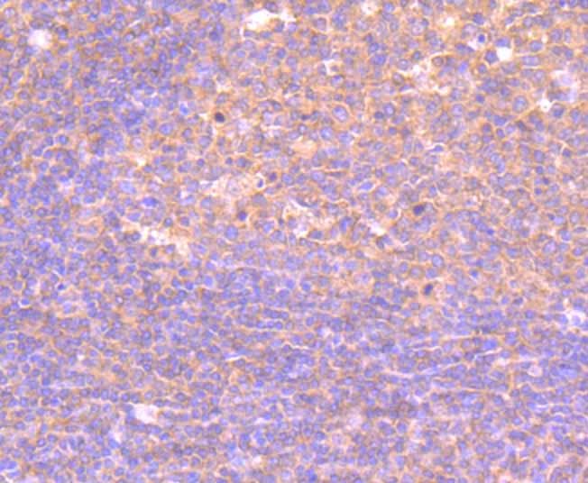 Immunohistochemical analysis of paraffin-embedded rat brain tissue using anti-PI3-kinase p85 subunit alpha antibody. Counter stained with hematoxylin.