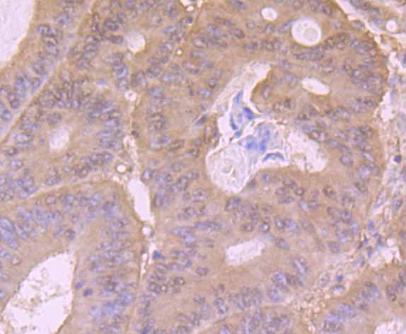 Immunohistochemical analysis of paraffin-embedded human tonsil tissue using anti-PI3-kinase p85 subunit alpha antibody. Counter stained with hematoxylin.