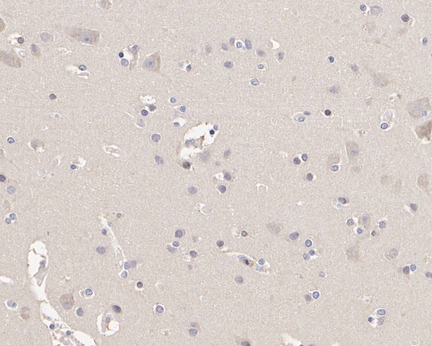 Immunohistochemical analysis of paraffin-embedded human placenta tissue using anti-PI 3 Kinase p85 alpha antibody. Counter stained with hematoxylin.