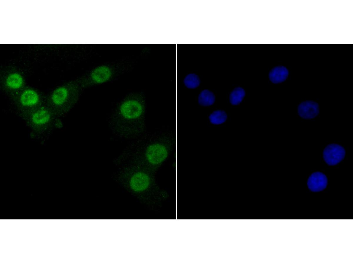 ICC staining PTBP1 in A549 cells (green). The nuclear counter stain is DAPI (blue). Cells were fixed in paraformaldehyde, permeabilised with 0.25% Triton X100/PBS.