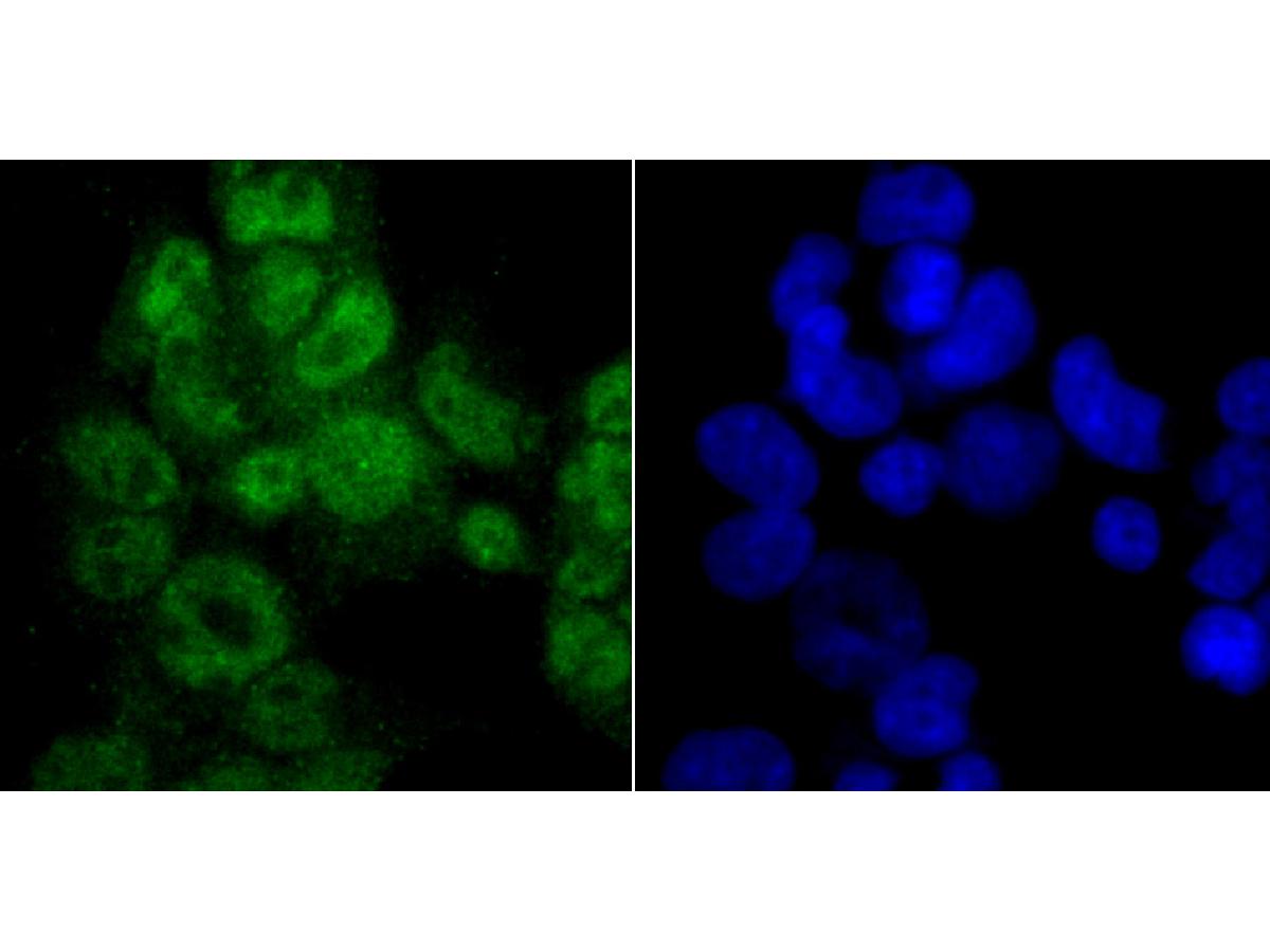 ICC staining PTBP1 in 293T cells (green). The nuclear counter stain is DAPI (blue). Cells were fixed in paraformaldehyde, permeabilised with 0.25% Triton X100/PBS.