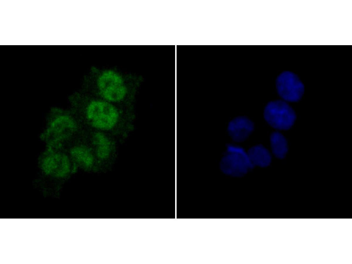 ICC staining PTBP1 in SW480 cells (green). The nuclear counter stain is DAPI (blue). Cells were fixed in paraformaldehyde, permeabilised with 0.25% Triton X100/PBS.