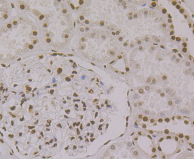 Immunohistochemical analysis of paraffin-embedded human kidney tissue using anti-PTBP1 antibody. Counter stained with hematoxylin.